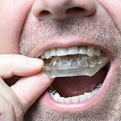 If you play sports or grind your teeth, wear a dentist approved mouth guard