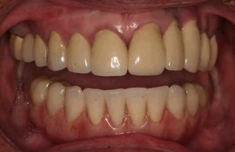 case 5 after