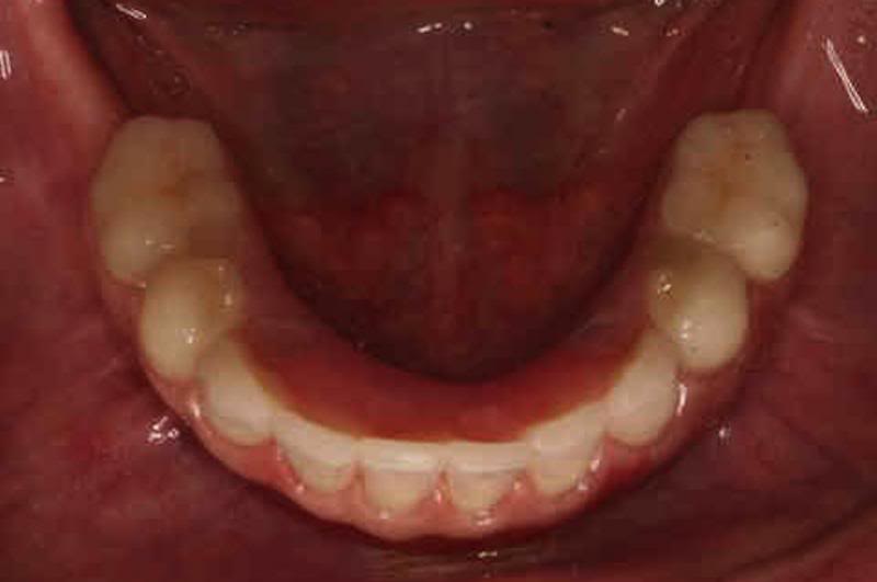 case 5 bottom row after