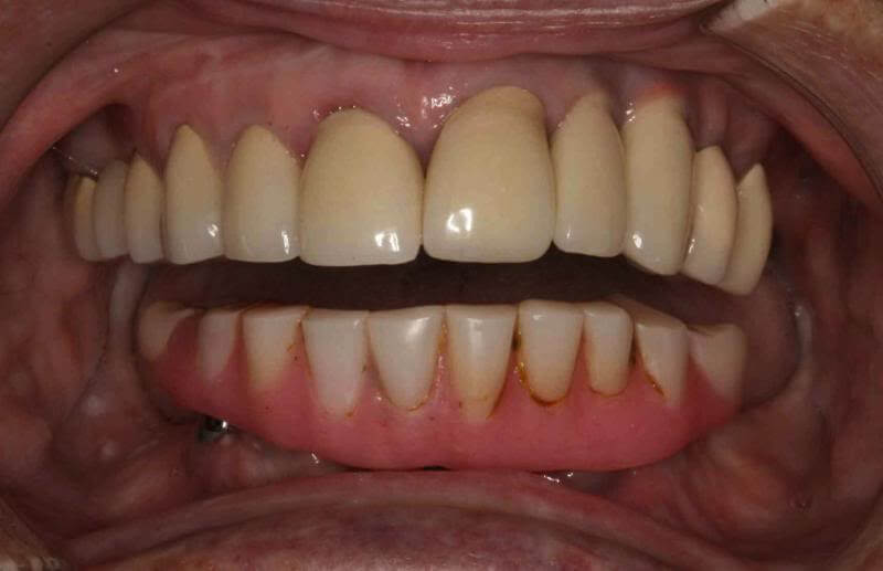 case 5 before