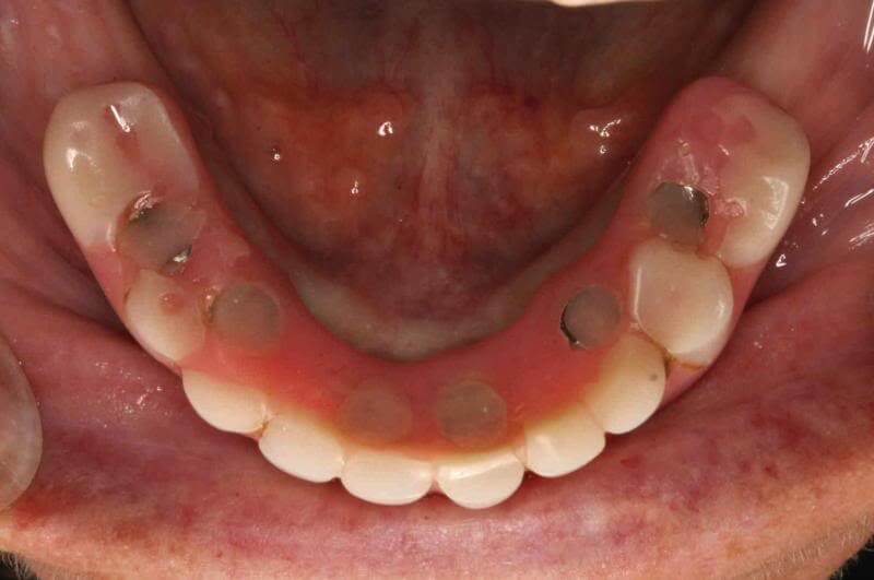 case 5 bottom row before
