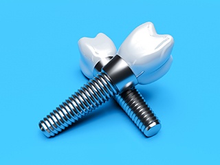 Closeup of 2 dental implants on blue background 