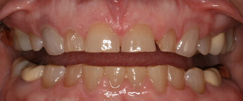 A smile before cosmetic work