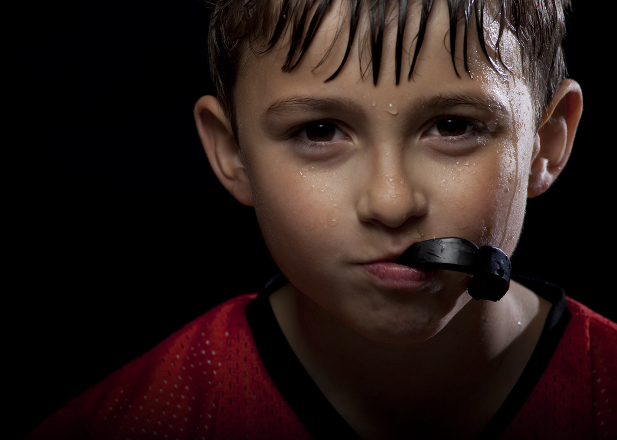 Sports mouthguards for prevention of concussions, brain trauma and