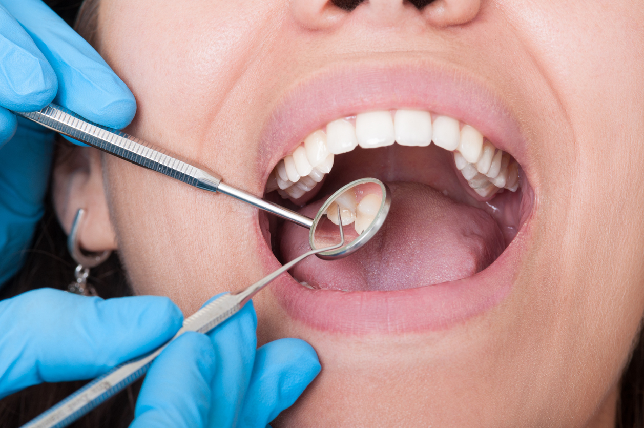 What Are The Dangers Of Neglecting Your Oral Health? - Ponte Vedra Complete Dentistry