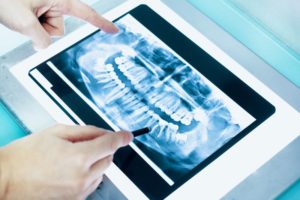 Dentist in Ponte Vedra Beach examining dental X-Rays