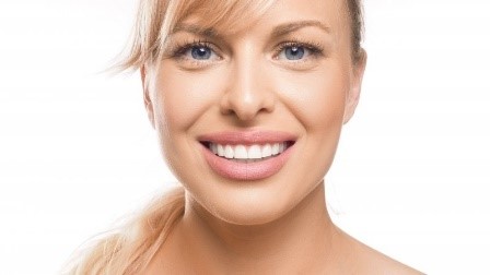 woman smiling with veneers