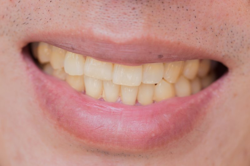 Close-up of a man with yellow teeth