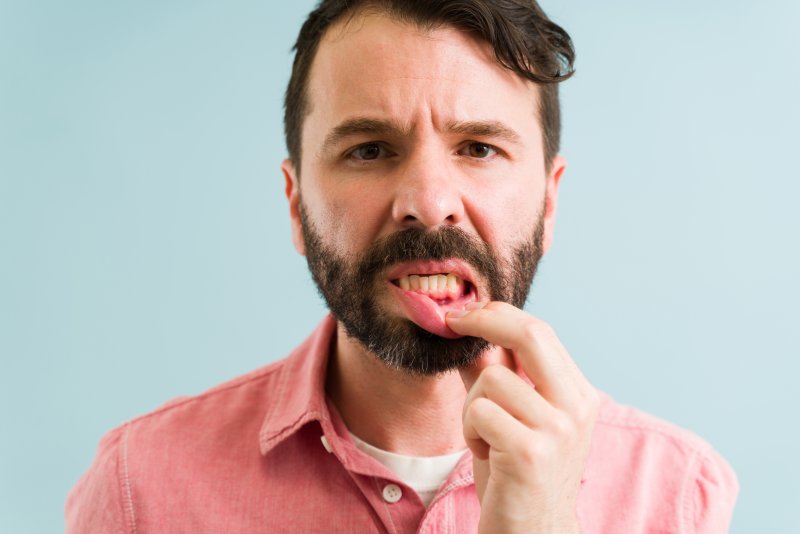 A young man suffering from gum disease