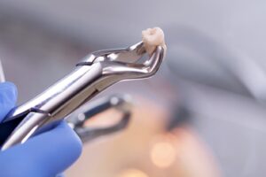 Dental pliers holding an extracted tooth